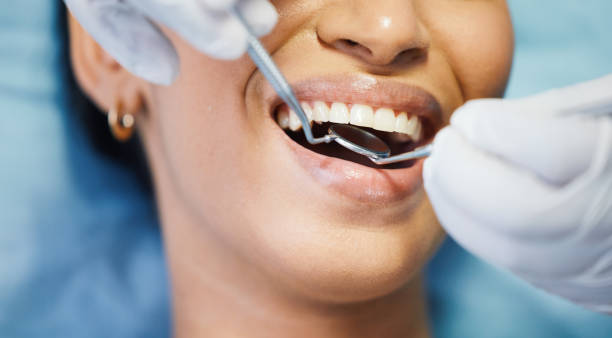 Best Emergency Dental Care for Abscessed Tooth in Ridgway, PA