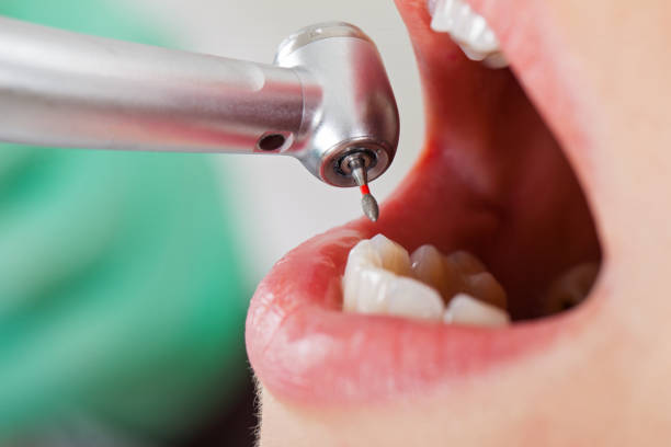Best Broken or Cracked Tooth Emergency Dentist in Ridgway, PA